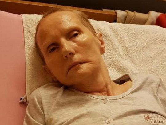 Apel rodziny ze Zblewa: Pomóżcie nam uratować naszą kochaną mamę