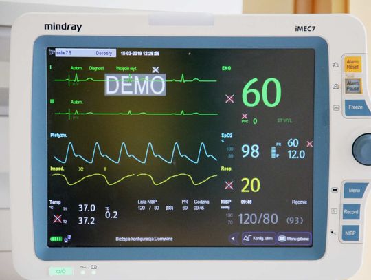 Będą nowe respiratory, kardiomonitory i mikroskop 3D. Ponad 10,5 mln zł na sprzęt dla szpitali marszałkowskich