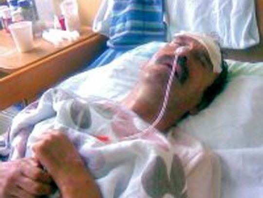 "Brat nie ma szans na przeżycie"