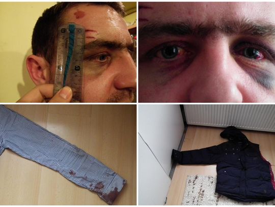 Doniesienie na policjantów w Kwidzynie