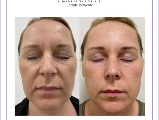 Kosmetologia estetyczna we Wrocławiu