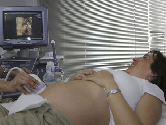 Miasto dokłada 125 tys. do sprzętu. A radny pyta: czy to wpłynie na kolejki?