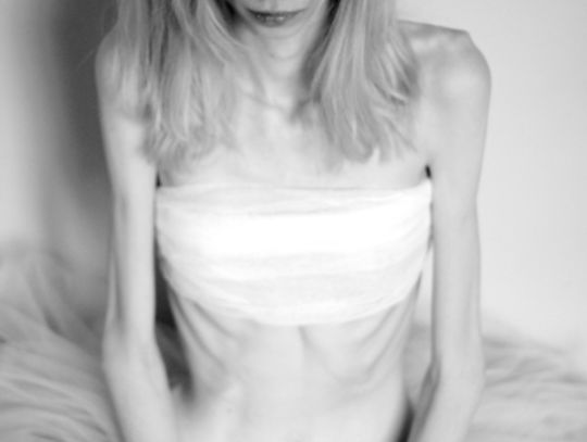 Na granicy życia i śmierci. Wstrząsające wyznania chorej na anoreksję