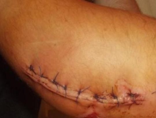 Nasza interwencja: wystający krawężnik naprawiony! Nikt już się nie przewróci