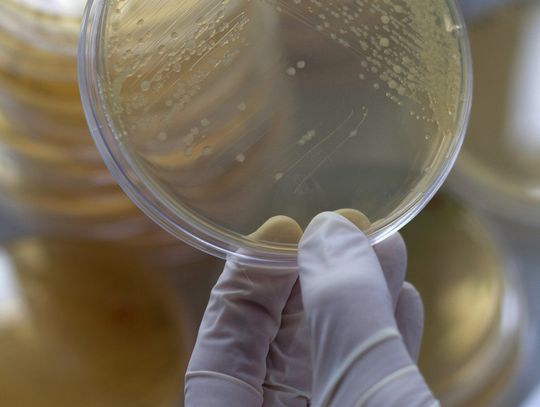 Sanepid wykrył w Polpharmie bakterie E coli!