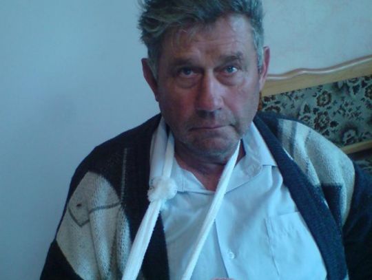 W kolejce do lekarza z uciętym palcem - pacjent zamiast do szpitala trafił do przychodni 