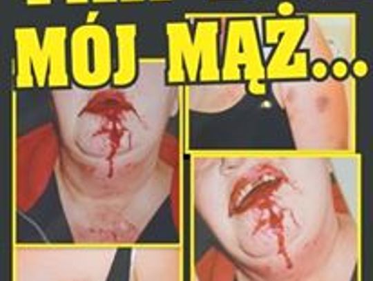 Życie w ciągłym strachu. Kobieta mieszka pod jednym dachem z mężem oprawcą, bo ten nie chce się wyprowadzić