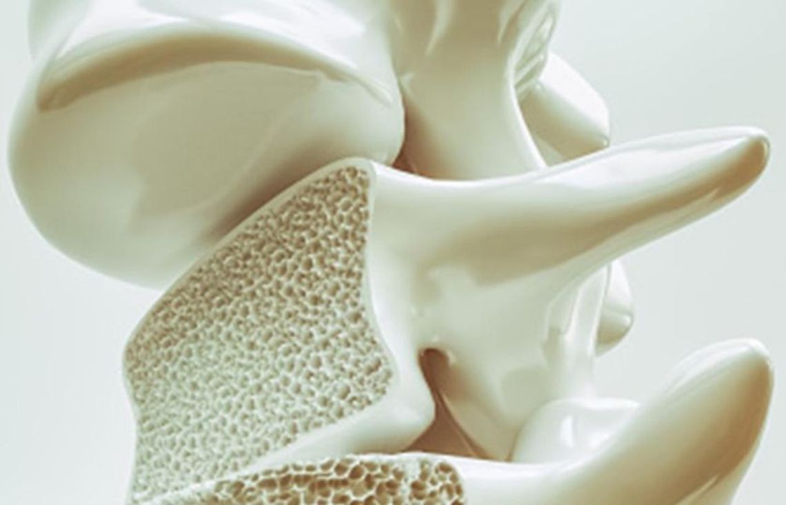 24 czerwca 2025 r. - Ważny dzień w kalendarzu. Światowy Dzień Chorych na Osteoporozę 24 czerwca 2025 r. - Ważny dzień w kalendarzu. Światowy Dzień Chorych na Osteoporozę