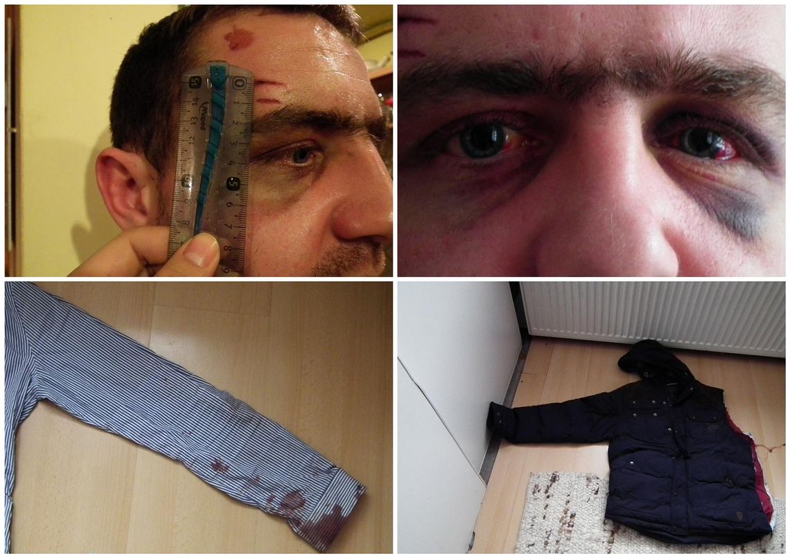 Doniesienie na policjantów w Kwidzynie Doniesienie na policjantów w Kwidzynie