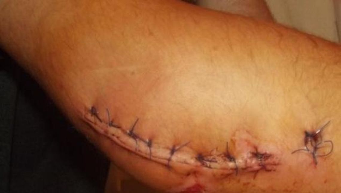 Nasza interwencja: wystający krawężnik naprawiony! Nikt już się nie przewróci