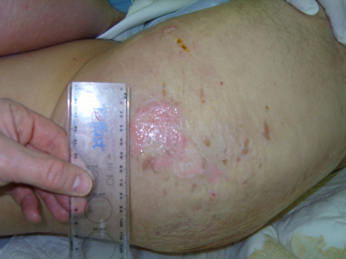 Pobity w szpitalu?! Pobity w szpitalu?!