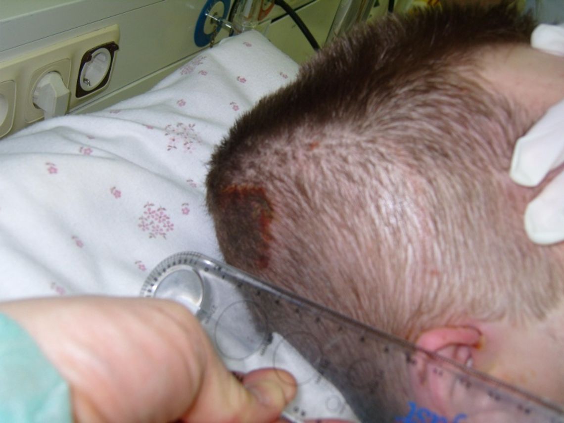 Prokuratura zajęła się sprawą pobicia w szpitalu Prokuratura zajęła się sprawą pobicia w szpitalu