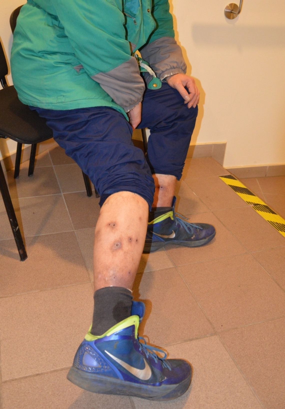 „Te małe muszki wkrótce zjedzą mnie całego”. Nasz Czytelnik chciał tylko, by ktoś mu pomógł... „Te małe muszki wkrótce zjedzą mnie całego”. Nasz Czytelnik chciał tylko, by ktoś mu pomógł...