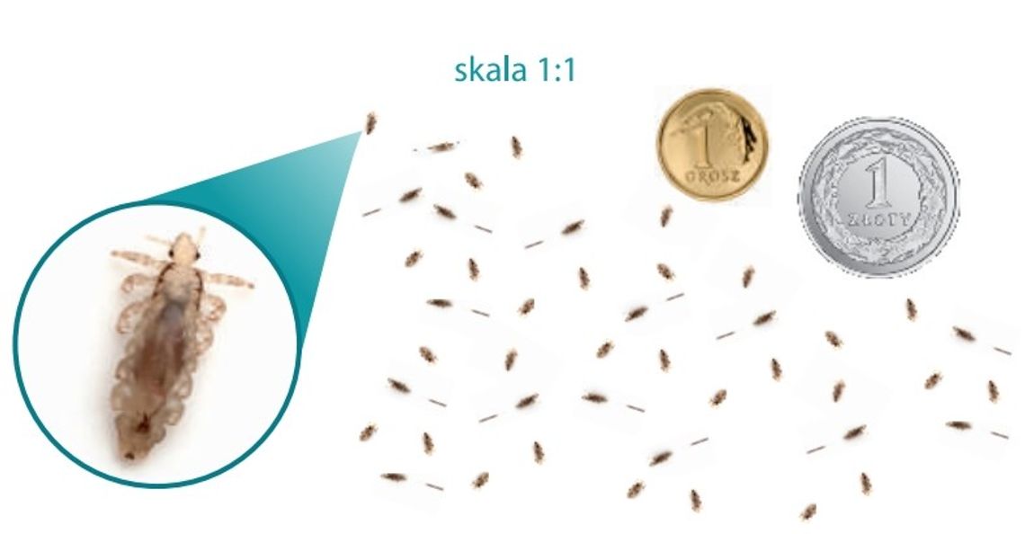 Wszawica zaatakowała szkoły? Wszawica zaatakowała szkoły?