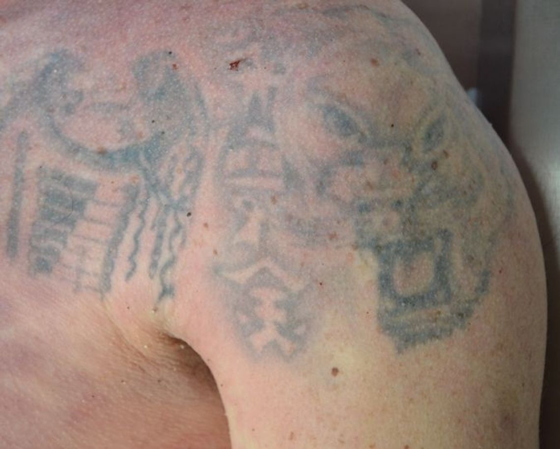 Znaleziono zwłoki męźczyzny na plaży w Sopocie Znaleziono zwłoki męźczyzny na plaży w Sopocie